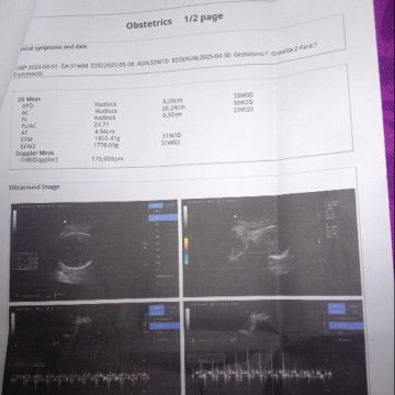 Djj terlalu cepat apakah bahaya