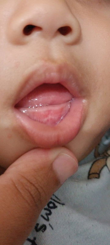 Ciri-ciri tumbuh gigi