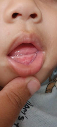 Ciri-ciri tumbuh gigi