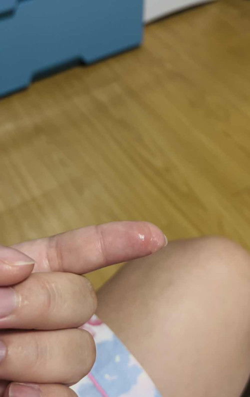 37+3 wk มีน้ำใสๆ เหนียวๆ ไหลออกมา จาก🍼