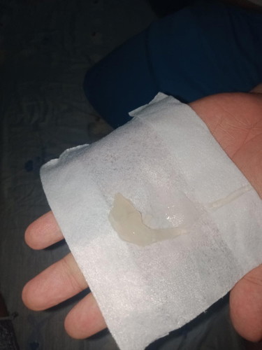 Mucus plug.