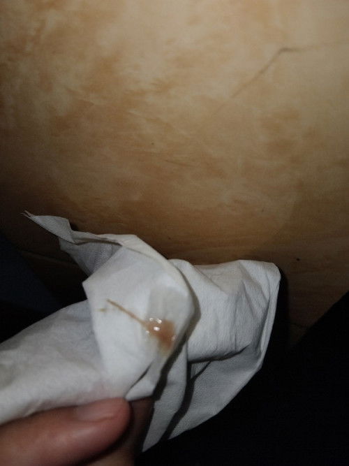 keputihan tapi warna seperti darah