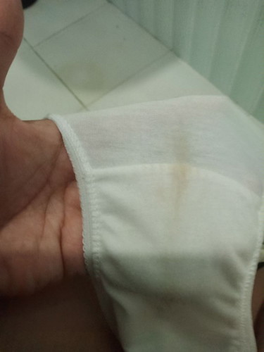 Hello po ask ko lng kung normal po ba yung ganyan wala nmn pananakit ng puson at balakang