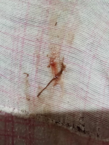 30weeks brown discharge