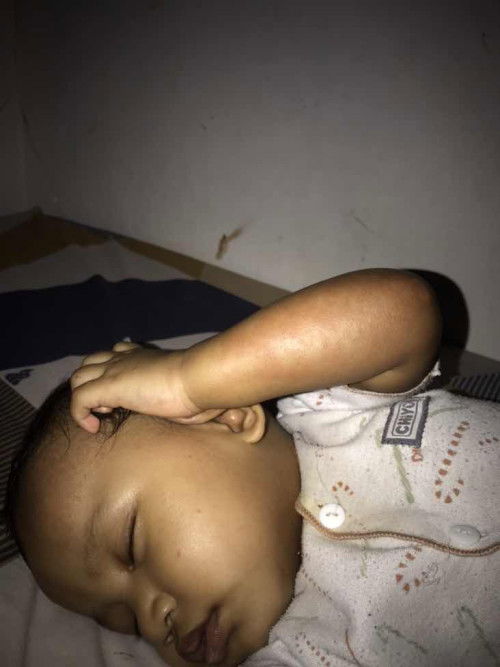 Ruam tangan bagian bawah