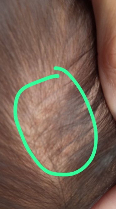 Kulit kepala bayi 9 bulan