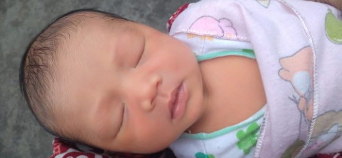 Apakah kuning
