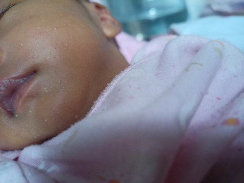 Bintik bintik putih di wajah