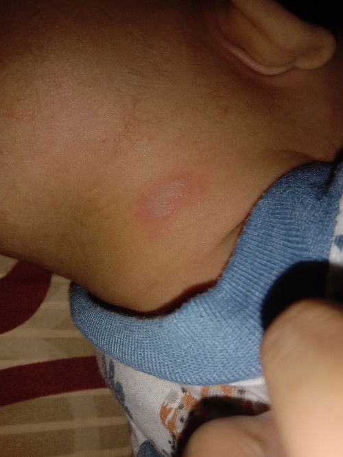 Bantu jawab Bun ini kenapa