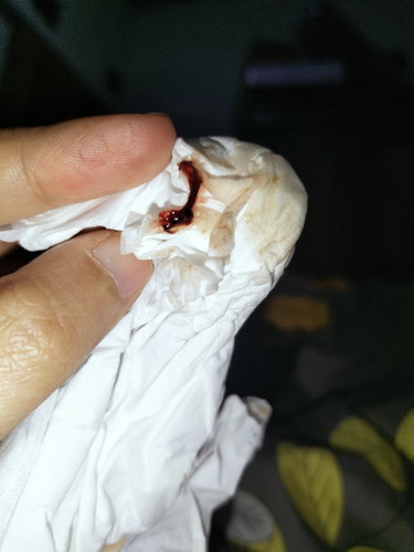 Flek seperti gumpalan