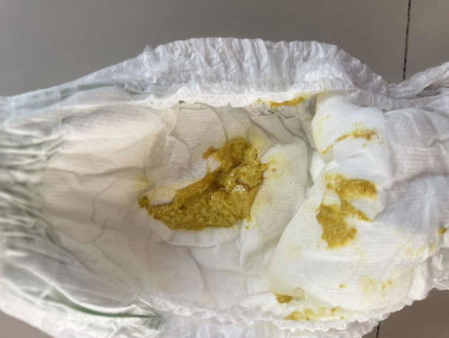 ลูก 2 เดือนขับถ่ายแบบนี้ปกติมั้ยค่ะ ต้องหาหมอมั้ยค่ะ