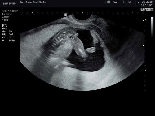 ลุ้นเพศลูกมากค่ะ😂