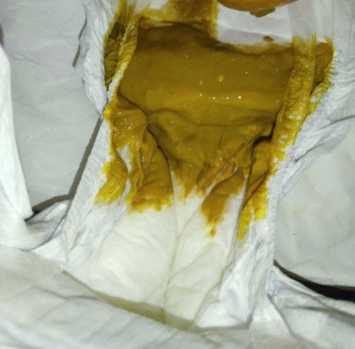 3mos old mix feeding poops.