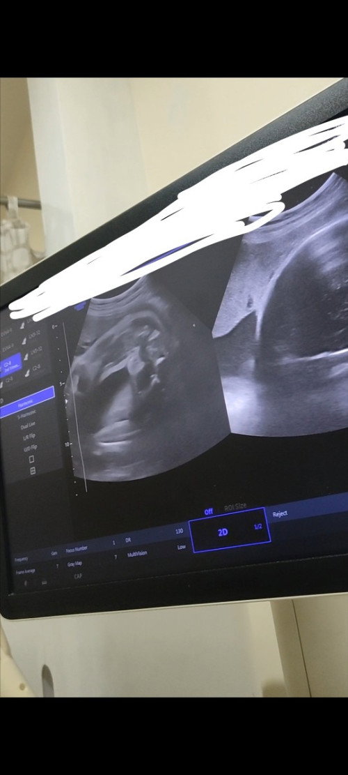 Gender pelvic ultrasound