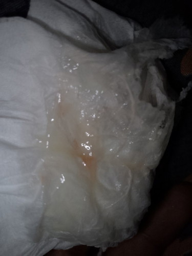 39+4 มีมูกปนเลือดออก ต้องรีบไป ร.พ หรือ รอดูอาการก่อนค่ะ