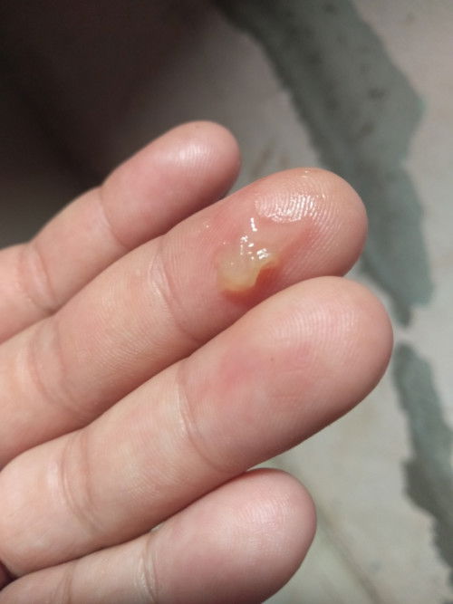 อยากทราบว่าไกล้คลอดรึยังคะ