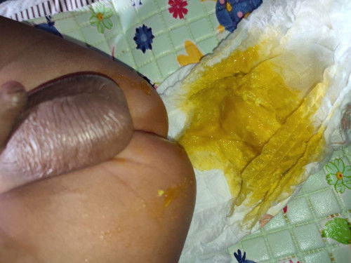 Maaf agak jorok bund (bab bayi 3 bulan)