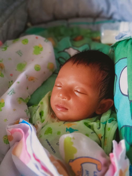 ผื่นนทารกก