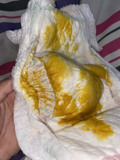 น้อง 2 เดือน 20 วัน