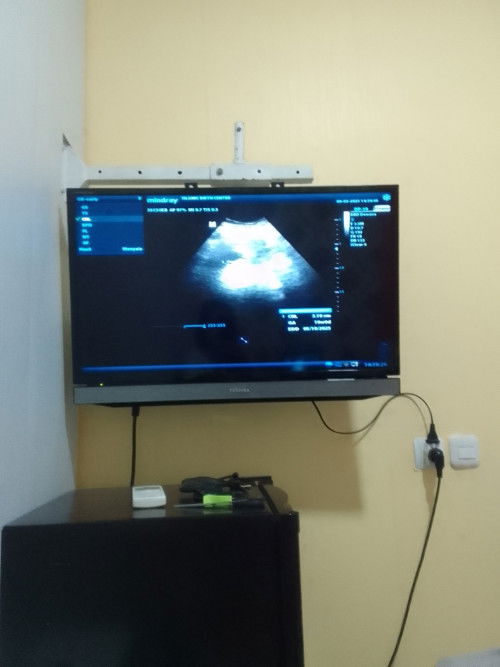 Wajar gak bun 10minggu janin masih kecil bgt