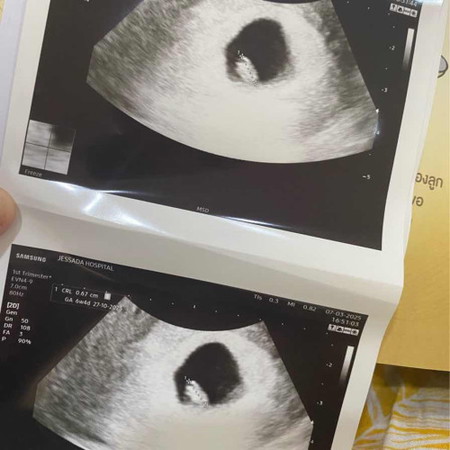 ถุงไข่แดง 6วีค