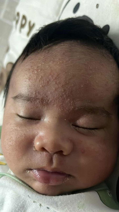 มีบ้านไหนเป็นมั้ยคะ🥹