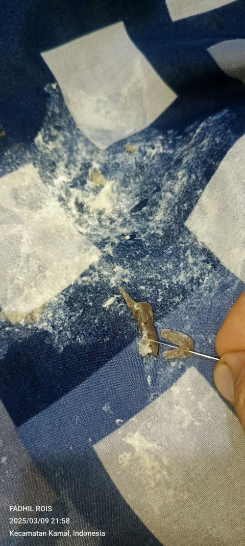 Tanya soal muntah pada bayi usia 7 bln