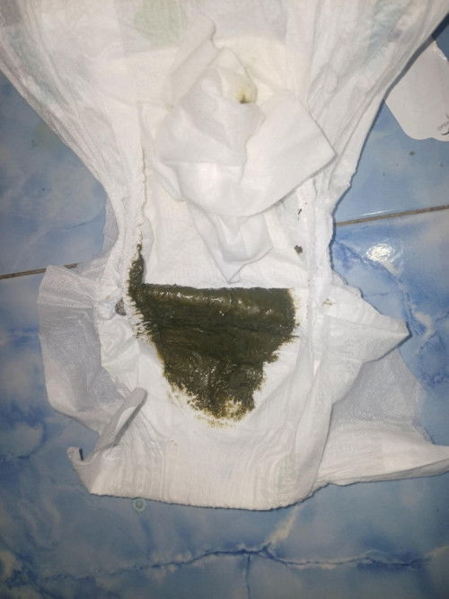 ลูกถ่ายผิดปกติหรือไม่