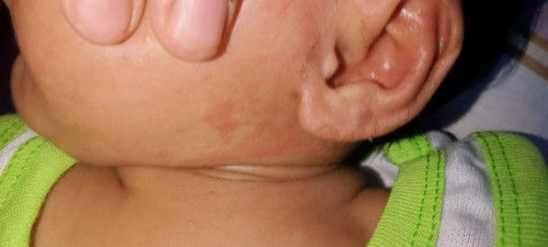 ada cream yg ampuh ga buat ilangin ini?