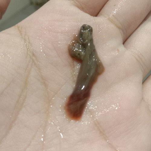 Saya pernah ada macam nie kandungan baru masuk 19 minggu.. Risau juga kadang ada kadang tak ada