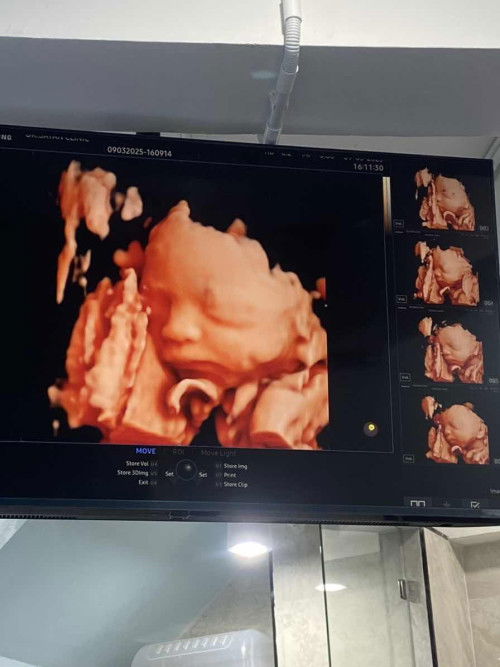 ทีม มิ.ย ได้เพศอะไรกันบ้างคะแม่ๆ😊