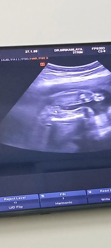 แม่ๆช่วยดูหน่อยค่ะ