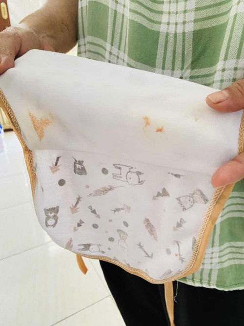 Bayi usia 3 hari pipis ada darahnya, normal kah bund?