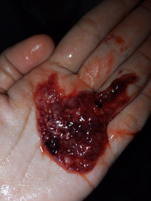 7w3d keluar gumpalan