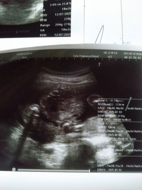 22w5d 
MasyaAllah sayang Ibuk bapak🤗