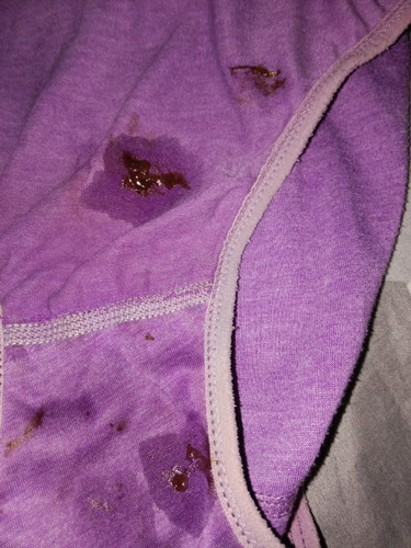 maaf jorok kmrin keluar flek sdikit trs lendir coklat bening tdi keluar lendir coklat pekat