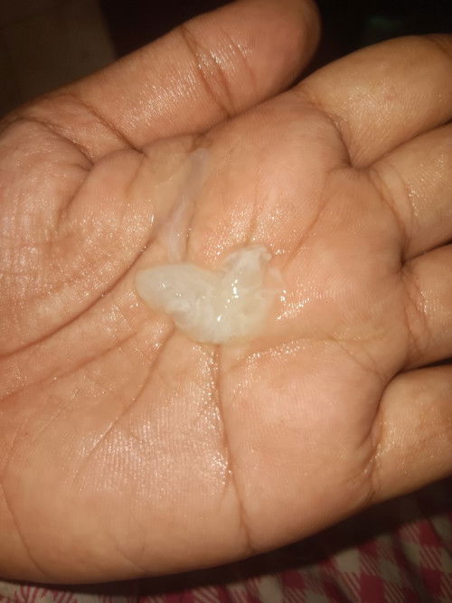 ทีม 13 มีนาคม 68