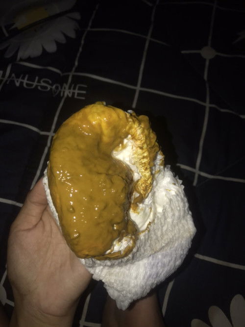 ถ่ายแบบนี้ปกติมั้ยคะ