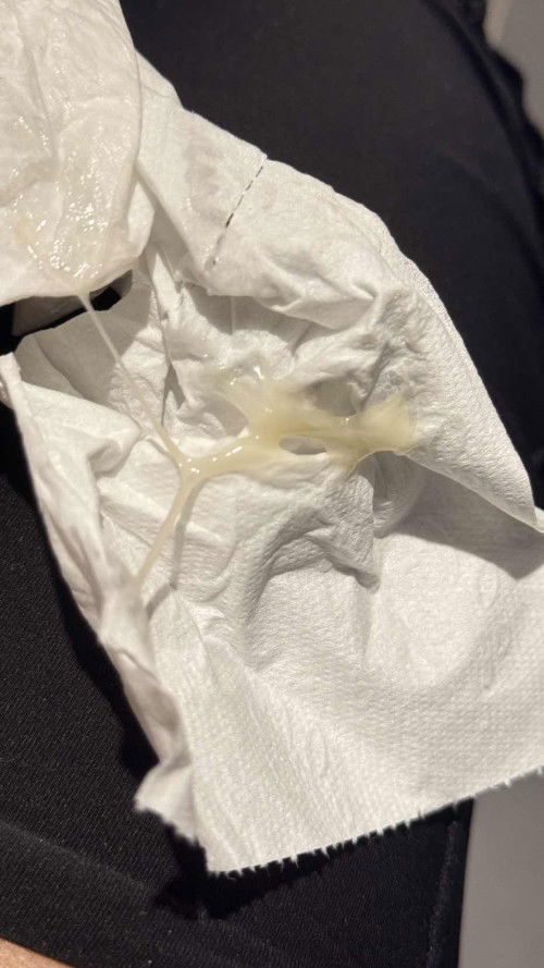 38+1 สัปดาห์