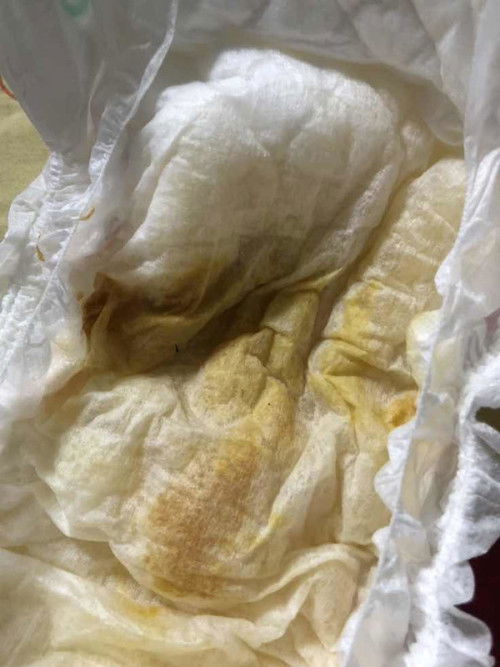 ทำไมฉี่ลูกเป็นแบบนี้ค่ะ