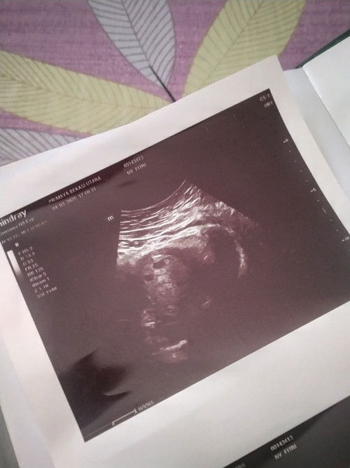 Hi moms.. di sini adakah yg hasil USGnya 'terlihat' ada 2 kantung?