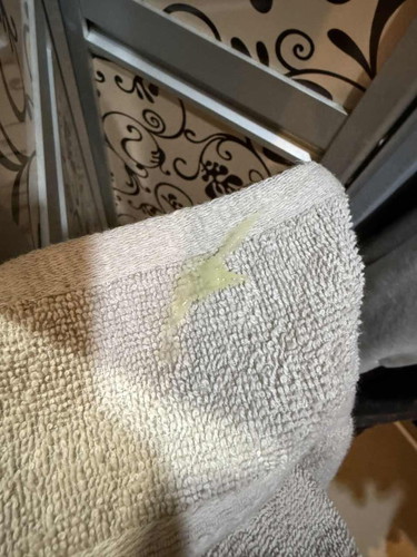 Mucus plug atau keputihan?