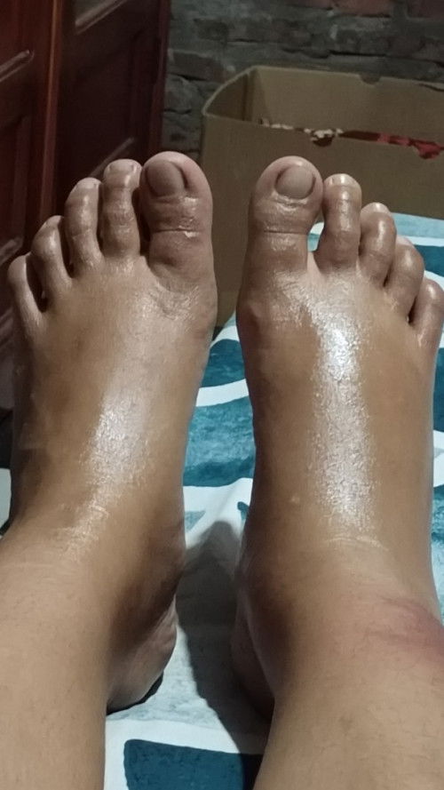 Kesehatan ibu dan janin