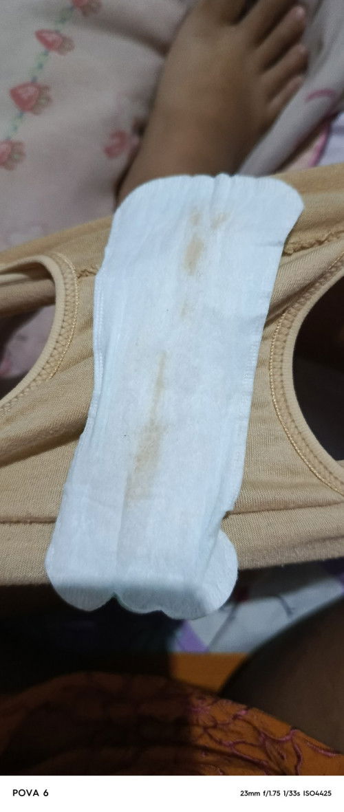 Cairan seperti flek?