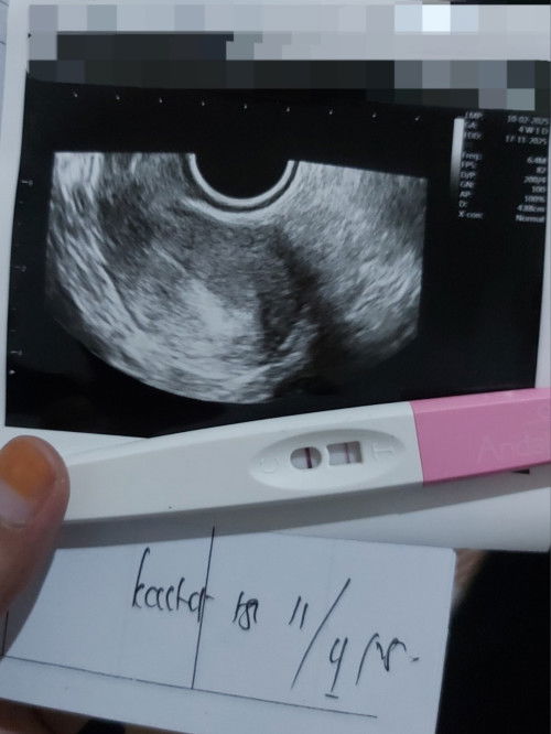 HPHT 10 Feb
Tadi pagi tespek garis 2 jelas dan malam ny langsung ke SpOG