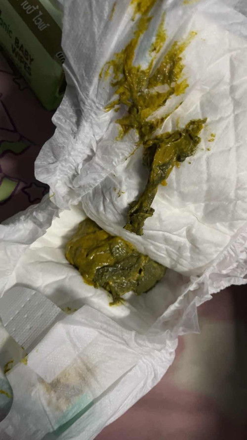 อึน้องปกติมั้ยค่ะ