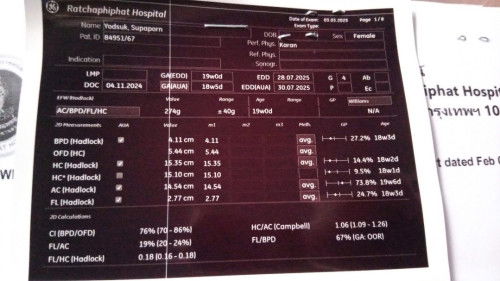 ใบอัลตร้าซาว