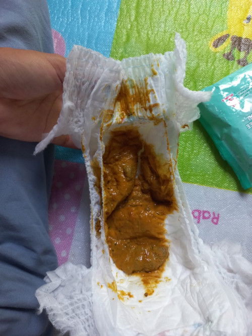 Bab bayi usia 7 bulan