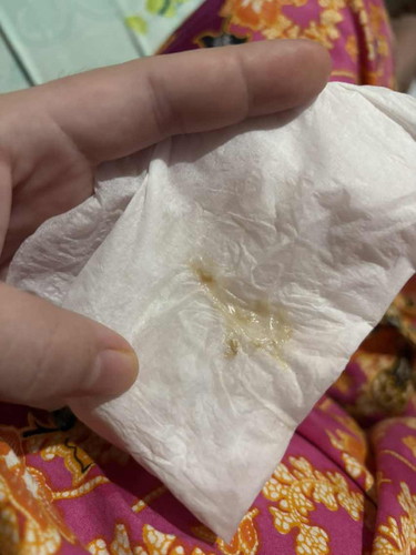 Mucus plug