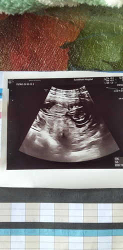 ท้องได้12วีค ประมาณกี่วีคคะถึงจะรู้เพศ